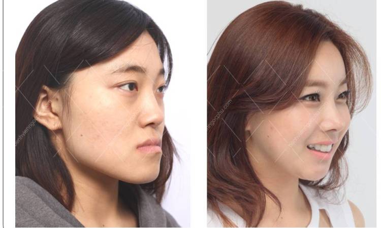 Jaw Orthopedics (Corrective Jaw Surgery)