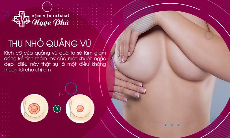 Tư Vấn Thu Nhỏ Quầng Vú