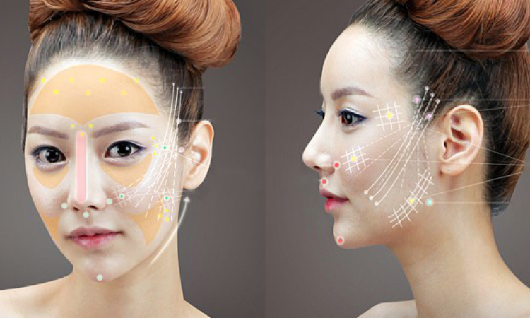 4D Collagen Thread Lift