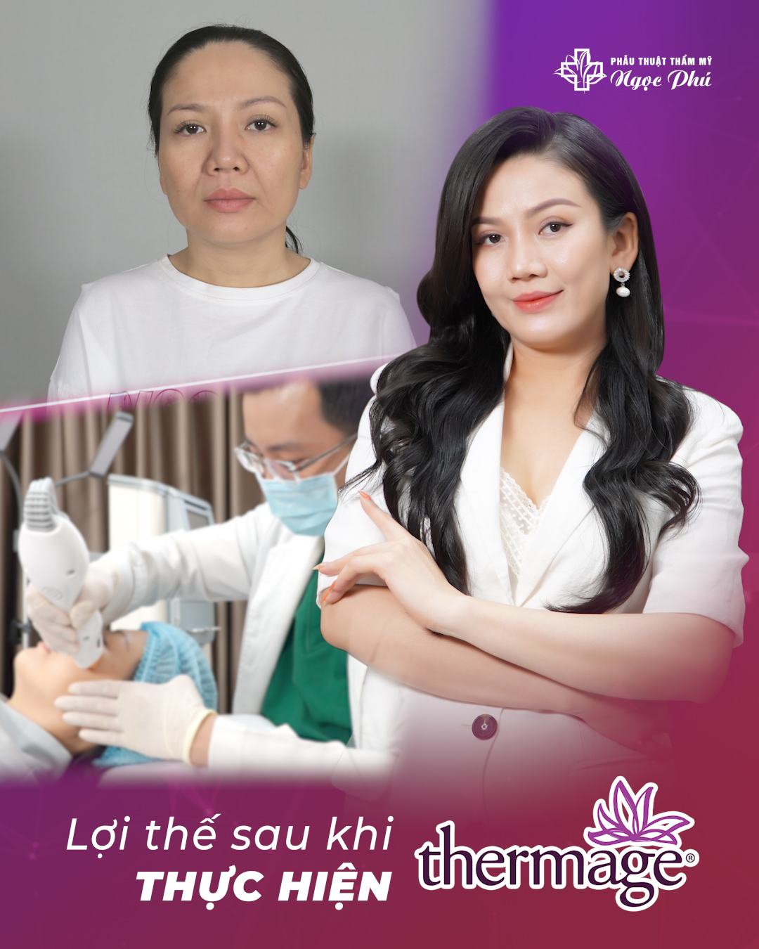 Thermage là một phương pháp điều trị thẩm mỹ không xâm lấn sử dụng sóng tần số vô tuyến (RF) để làm săn chắc và nâng cơ da.