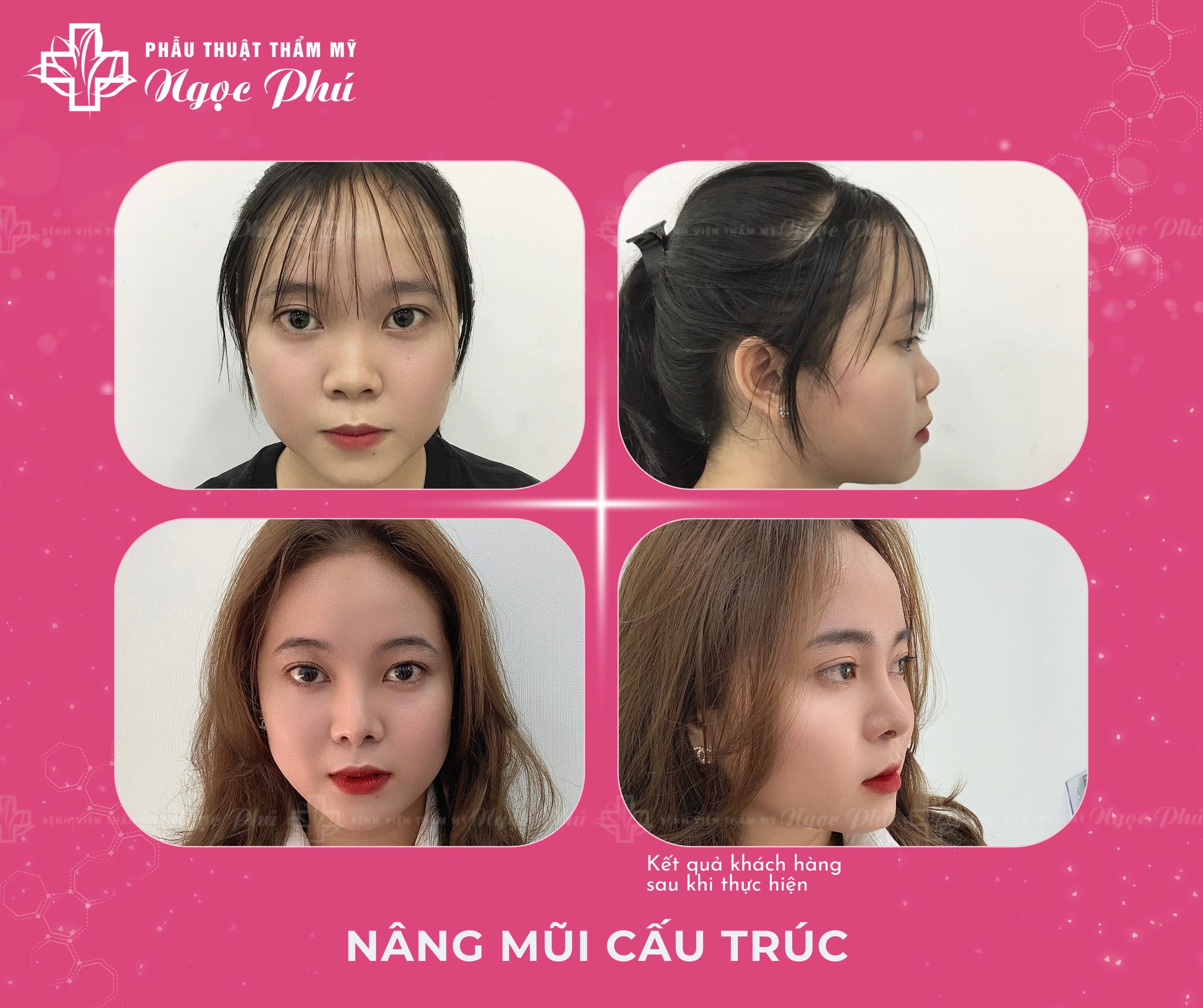 Thẩm Mỹ Thẩm Mỹ Việt Nam là nơi đáng tin cậy, tại đây chúng tôi được nhiều người tin tưởng chọn mặt gửi vàng để làm đẹp và tân trang lại nhan sắc.