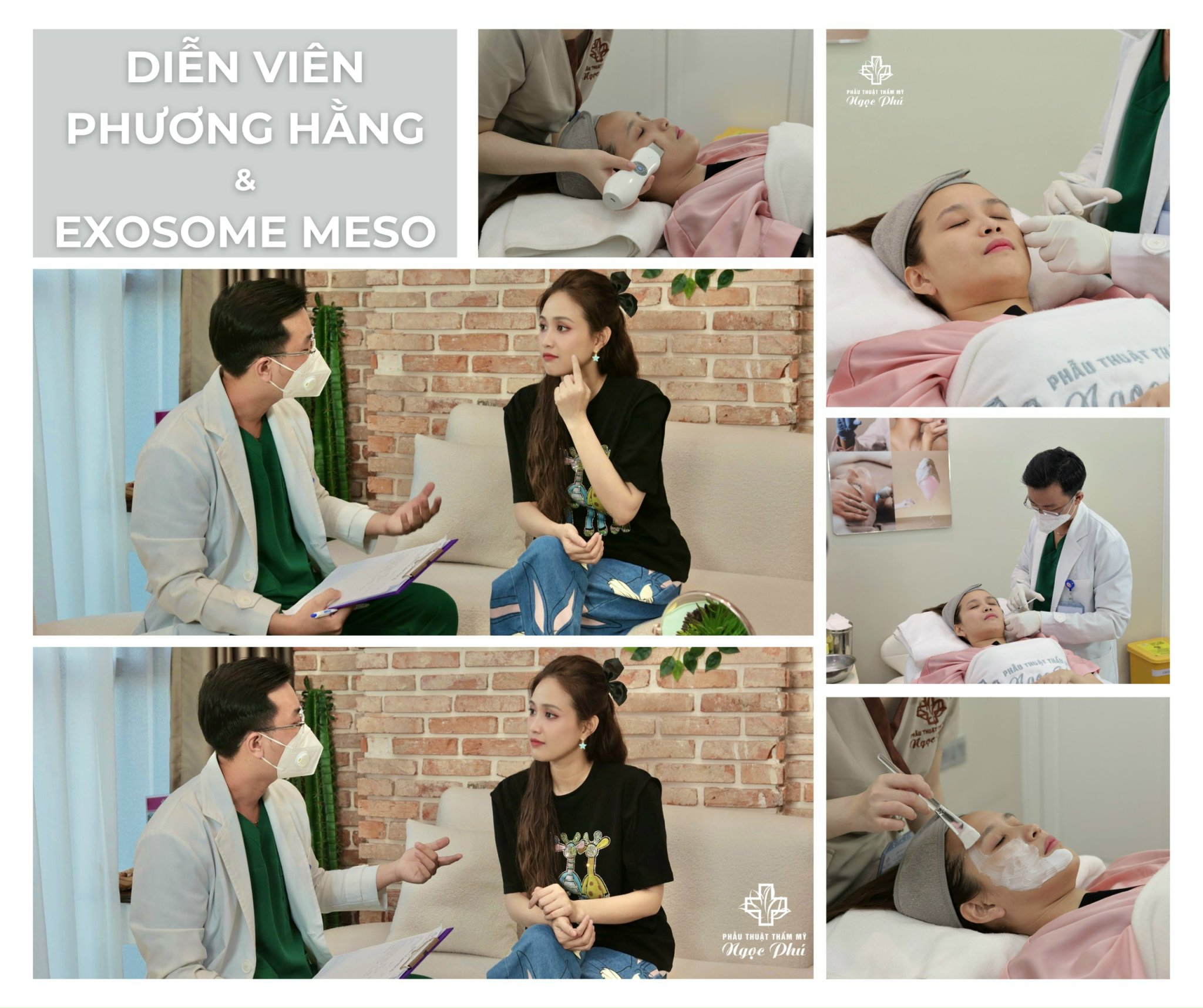 da bị mụn có tiêm Meso được không?