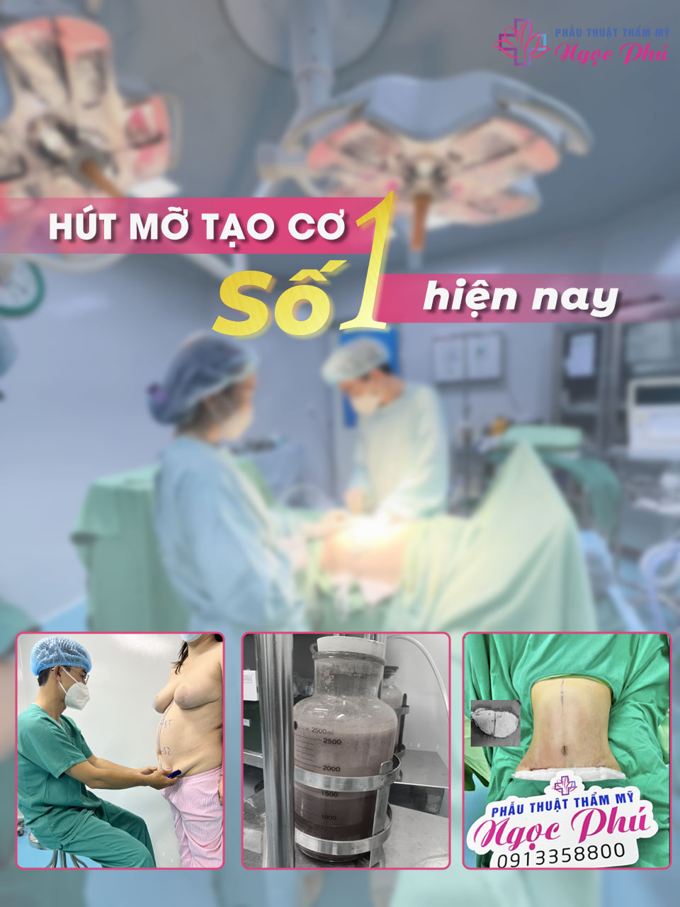 Trong những ngày đầu sau phẫu thuật, nên ăn các thức ăn lỏng, dễ tiêu hóa như cháo, súp để giảm áp lực cho hệ tiêu hóa. Tăng cường bổ sung protein từ thịt nạc, cá, trứng, sữa... Hạn chế đồ ăn cay nóng, nhiều dầu mỡ, đồ uống có cồn và các chất kích thích khác..