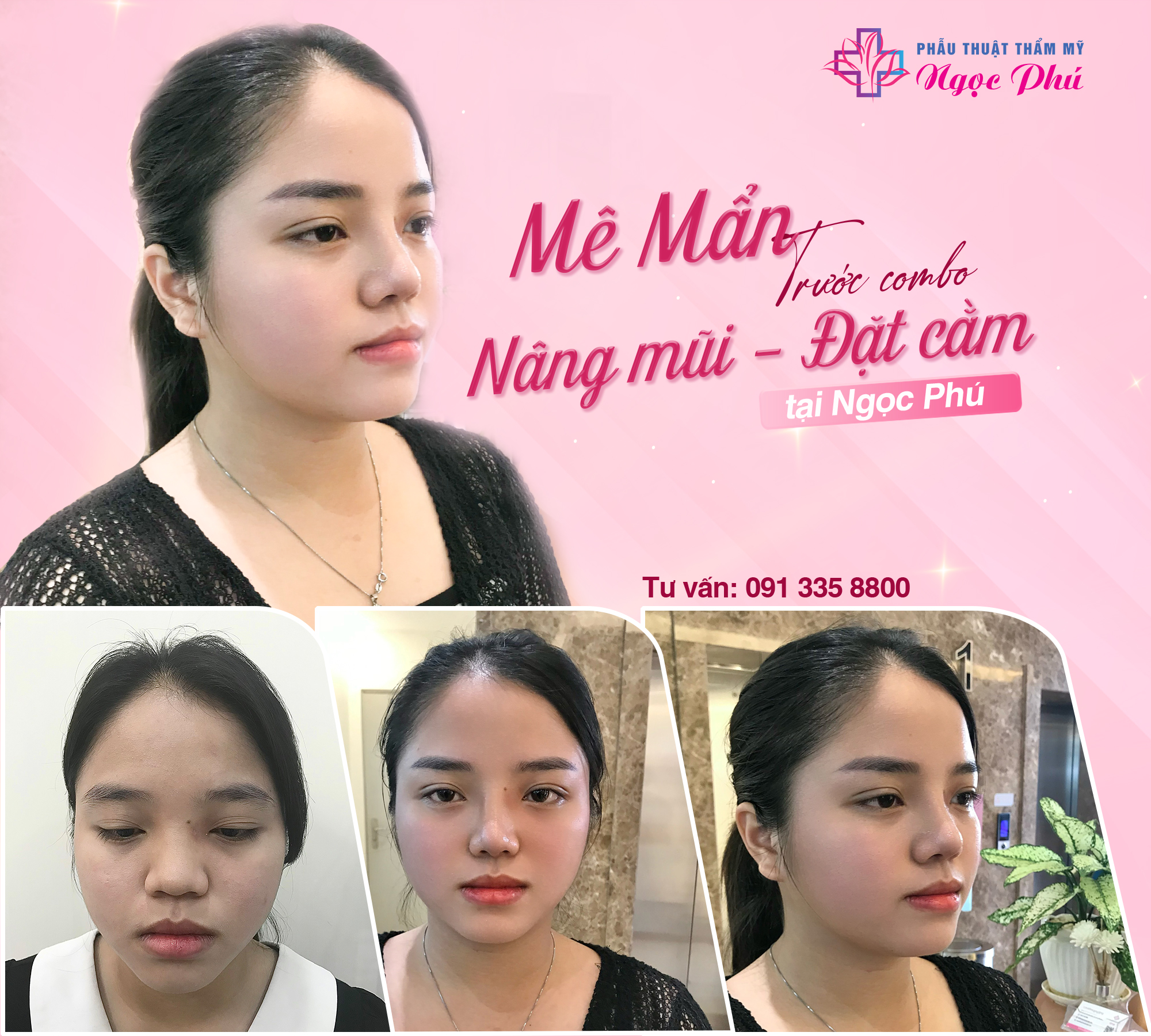 Cân xứng với ngũ quan và tổng thể đường nét trên gương mặt