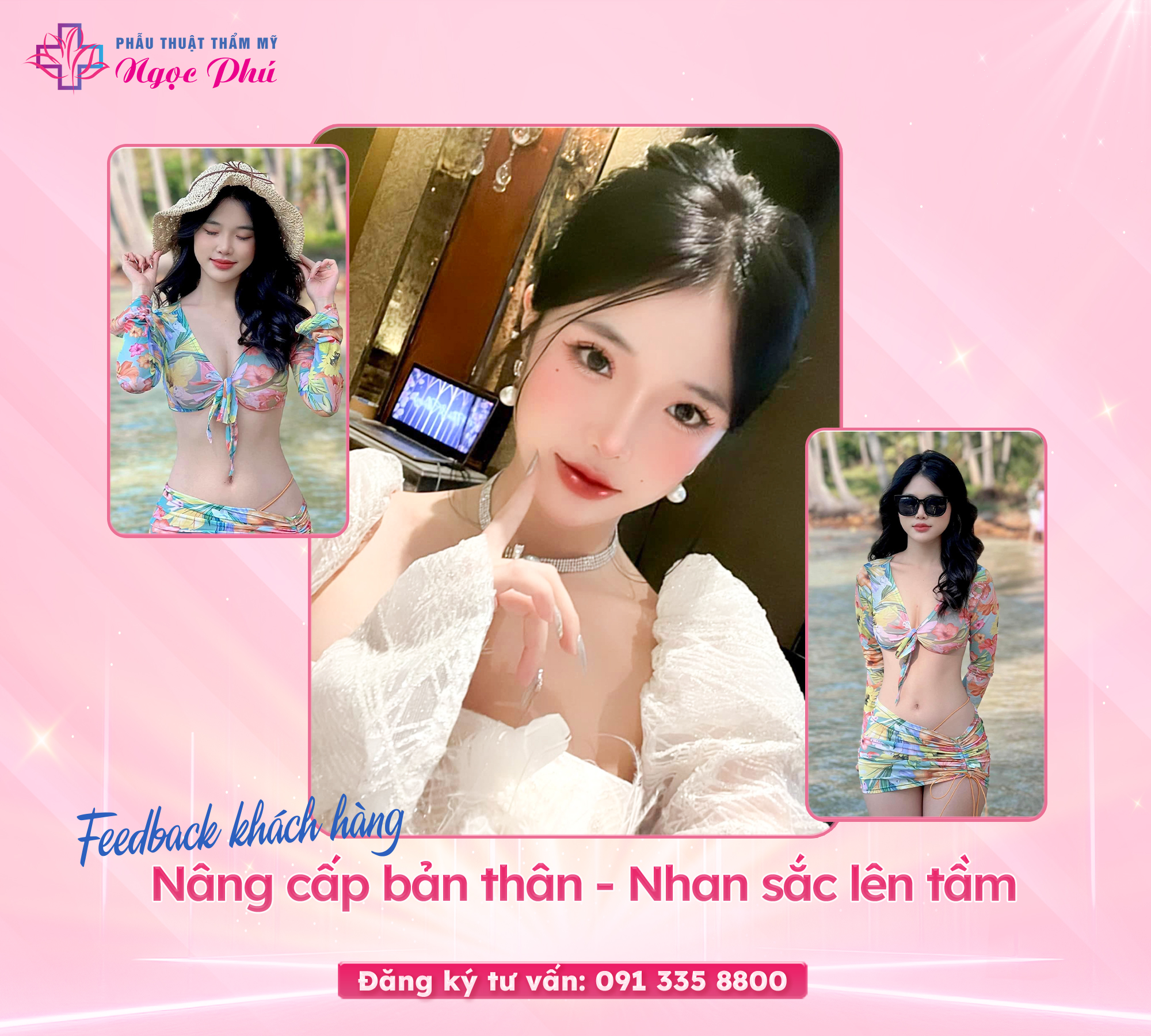 Phương pháp nâng mũi S-Line là phương pháp nâng mũi bắt nguồn từ Hàn Quốc. 