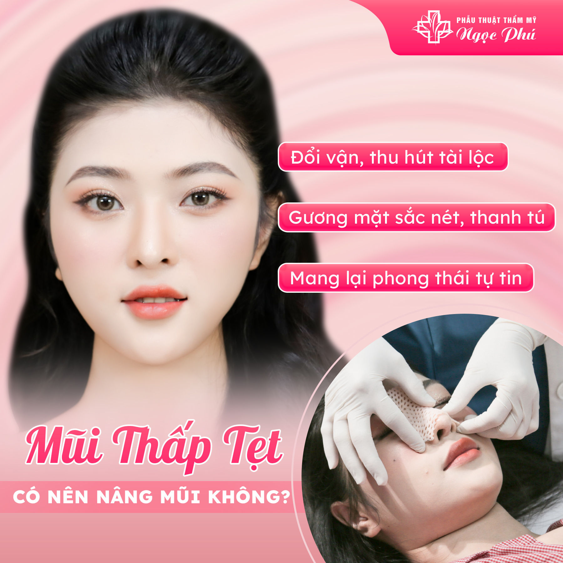 Mang lại dáng mũi cao, thon gọn, thanh tú, phù hợp với khuôn mặt người Á Đông